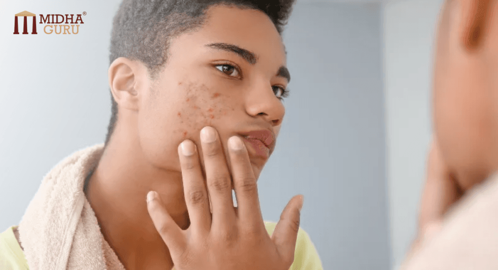 Acne to Emotions-Puberty changes and coping mechanism